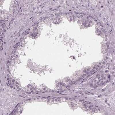 Immunohistochemistry-Paraffin: ADPRHL1 Antibody [NBP2-39073]