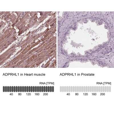 Immunohistochemistry-Paraffin: ADPRHL1 Antibody [NBP2-39073]
