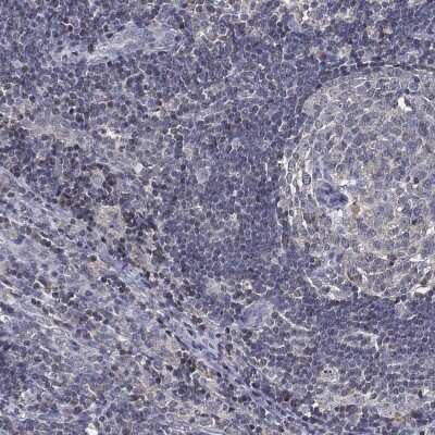 Immunohistochemistry-Paraffin: ADPRHL1 Antibody [NBP3-17098]