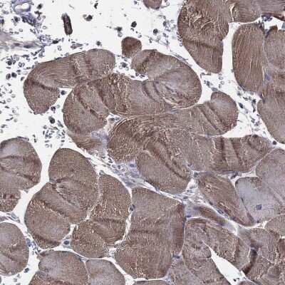 Immunohistochemistry-Paraffin: ADPRHL1 Antibody [NBP3-17098]