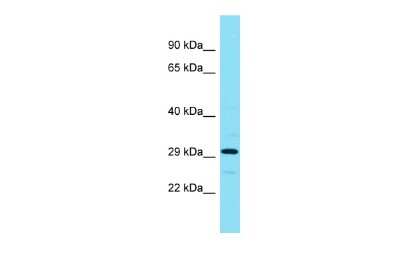 Western Blot: ADPRHL1 Antibody [NBP2-82583]