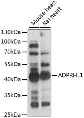 Western Blot: ADPRHL1 AntibodyAzide and BSA Free [NBP2-92248]