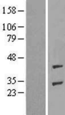 Western Blot: ADPRHL1 Overexpression Lysate [NBL1-07355]