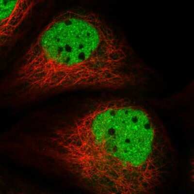 Immunocytochemistry/ Immunofluorescence: ADPRHL2 Antibody [NBP1-88835]