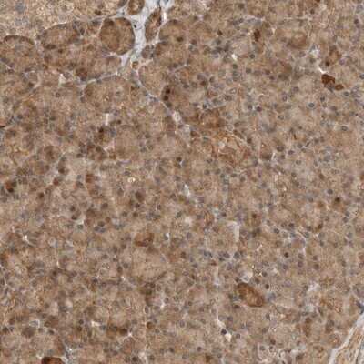Immunohistochemistry-Paraffin: ADPRHL2 Antibody [NBP1-88834]