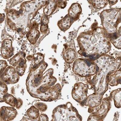 Immunohistochemistry-Paraffin: ADPRHL2 Antibody [NBP1-88834]
