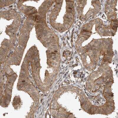 Immunohistochemistry-Paraffin: ADPRHL2 Antibody [NBP1-88834]