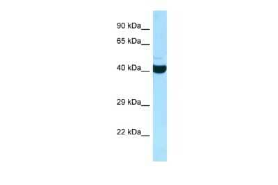 Western Blot: ADPRHL2 Antibody [NBP2-84401]