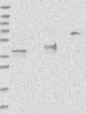 Western Blot: ADPRHL2 Antibody [NBP3-17334]