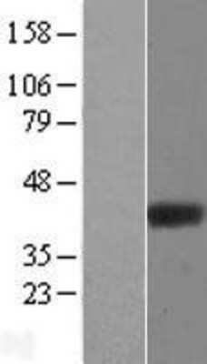 Western Blot: ADPRHL2 Overexpression Lysate [NBL1-07356]