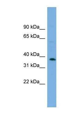 Western Blot: ADPRM Antibody [NBP1-70766]