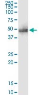 Immunoprecipitation: ADRM1 Antibody (3C6) [H00011047-M01]