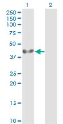 Western Blot: ADRM1 Antibody (3C6) [H00011047-M01]