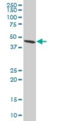 Western Blot: ADRM1 Antibody (3D11) [H00011047-M02]