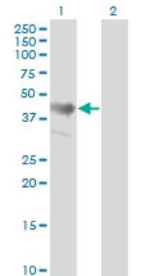 Western Blot: ADRM1 Antibody (3D11) [H00011047-M02]