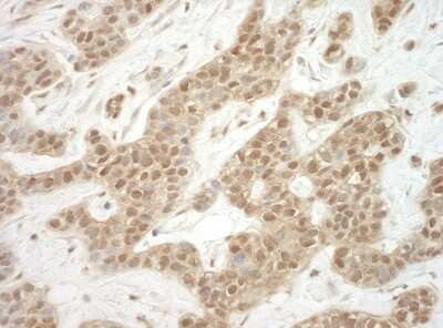 Immunohistochemistry-Paraffin: ADRM1 Antibody [NBP1-30446]