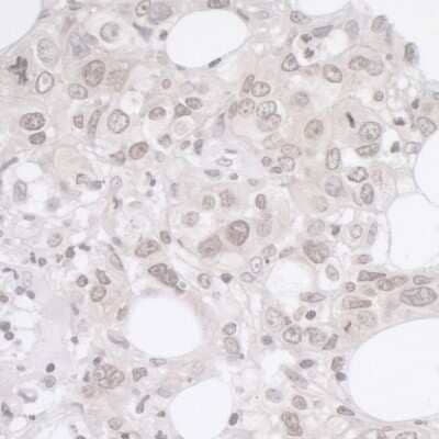 Immunohistochemistry-Paraffin: ADRM1 Antibody [NBP1-30447]