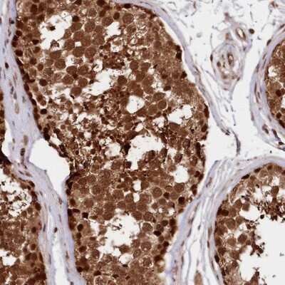 Immunohistochemistry-Paraffin: ADRM1 Antibody [NBP1-88993]