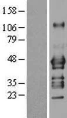 Western Blot: ADRM1 Overexpression Lysate [NBL1-07361]