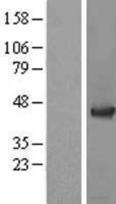 Western Blot: ADRM1 Overexpression Lysate [NBL1-07362]