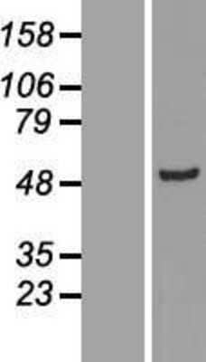 Western Blot: ADSSL1 Overexpression Lysate [NBL1-07365]