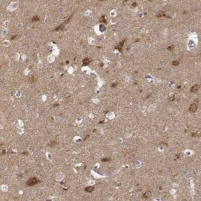 Immunohistochemistry-Paraffin: ADTB1 Antibody [NBP2-57886]