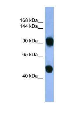 Western Blot: ADTB1 Antibody [NBP1-68947]