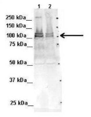 Western Blot: ADTB1 Antibody [NBP1-68947]