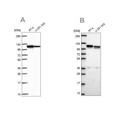 Western Blot: ADTB1 Antibody [NBP2-57109]