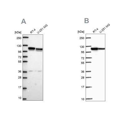 Western Blot: ADTB1 Antibody [NBP2-57886]