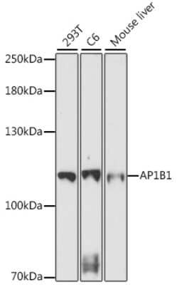 Western Blot: ADTB1 AntibodyAzide and BSA Free [NBP2-92312]