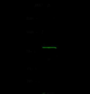 Western Blot: ADTB1 Antibody [NBP2-99079]