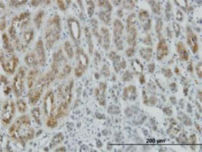 Immunohistochemistry-Paraffin: AE Binding Protein 1/ACLP Antibody (1D2) [H00000165-M01]