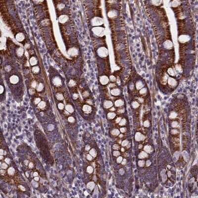 Immunohistochemistry-Paraffin: AE Binding Protein 1/ACLP Antibody [NBP2-49398]