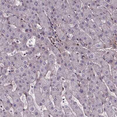 Immunohistochemistry-Paraffin: AE Binding Protein 1/ACLP Antibody [NBP2-49432]