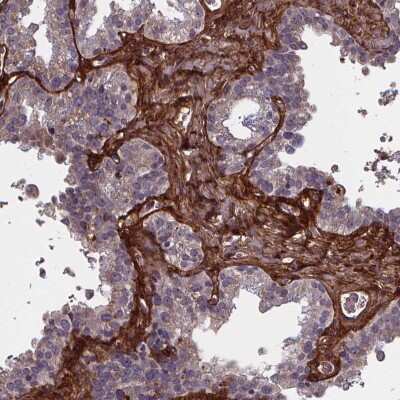Immunohistochemistry-Paraffin: AE Binding Protein 1/ACLP Antibody [NBP2-49432]