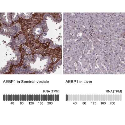 Immunohistochemistry-Paraffin: AE Binding Protein 1/ACLP Antibody [NBP2-49432]