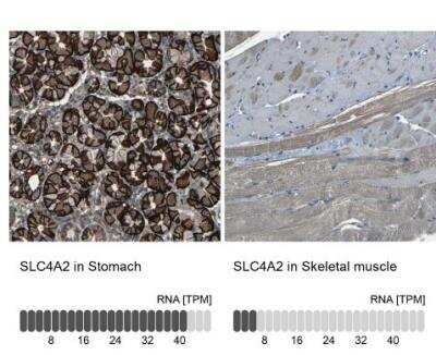 Immunohistochemistry-Paraffin: AE2 Antibody [NBP1-90225]