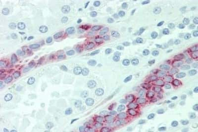 Immunohistochemistry-Paraffin: AE2 Antibody [NBP3-14535]