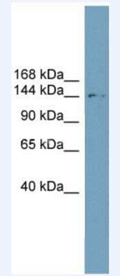 Western Blot: AE2 Antibody [NBP1-59858]