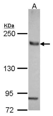 Western Blot: AE2 Antibody [NBP2-15301]