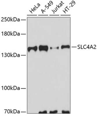 Western Blot: AE2 AntibodyAzide and BSA Free [NBP2-92513]