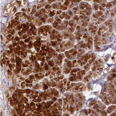 Immunohistochemistry: AEBP2 Antibody [NBP2-30712]