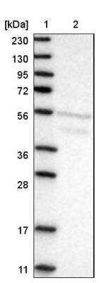 Western Blot: AEBP2 Antibody [NBP2-30712]