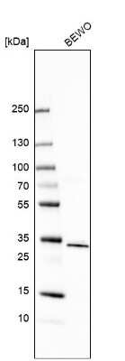 Western Blot: AEBP2 Antibody [NBP2-30712]