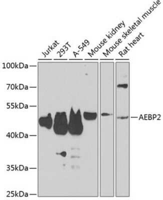 Western Blot: AEBP2 AntibodyBSA Free [NBP2-92913]