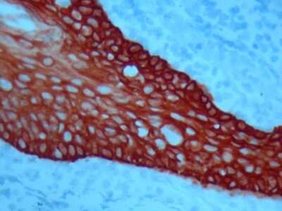 Immunohistochemistry-Paraffin: AEC Chromogen/Substrate [NB900-79773]