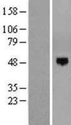 Western Blot: EOGT/AER61 Overexpression Lysate [NBP2-05128]