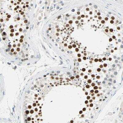 Immunohistochemistry-Paraffin: AF10 Antibody [NBP1-90222]