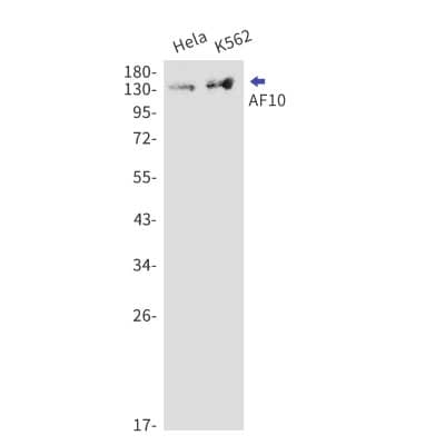 Western Blot: AF10 Antibody (S07-2G2) [NBP3-19560]